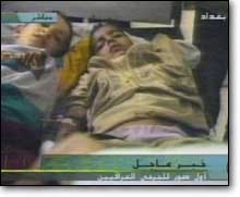 Irak televizyonu yaral ocuklarn grntlerini yaynlad.